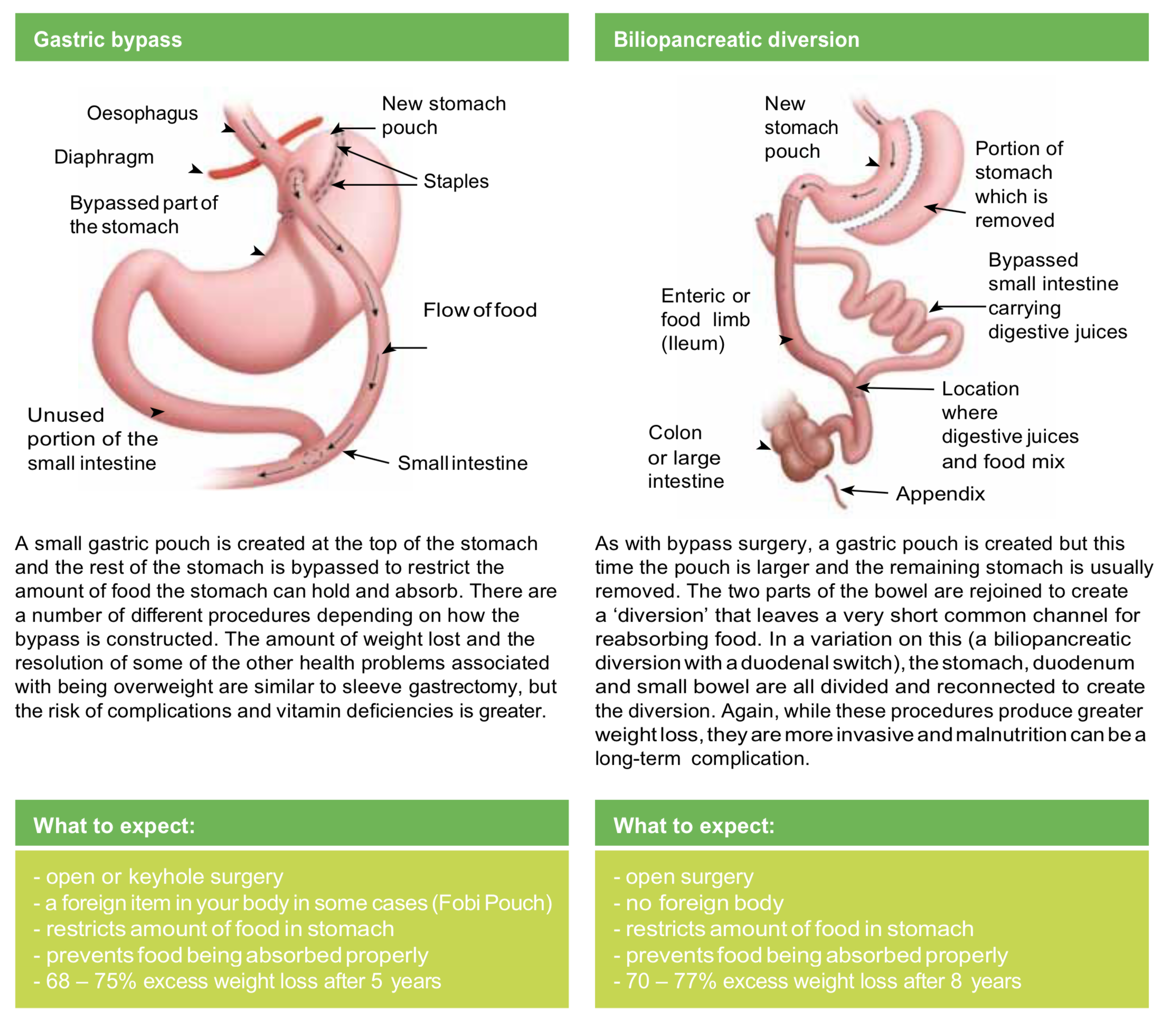 Surgical Options For Gastric Sleeve Procedures